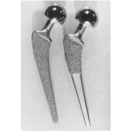 LCS Complete Porous-Coated Right Femoral Component - Small