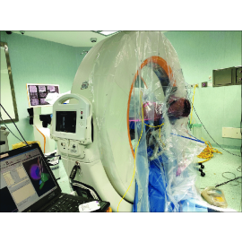 B +ve- Sterile Portable CT Scanner Drape Kit with Adhesive Strips 