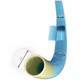 Cordis VISTA BRITE TIP® Guiding Catheter – Advanced Support and Performance for Coronary Interventions